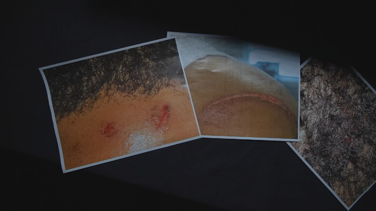 Shively animal clinic injuries.jpeg